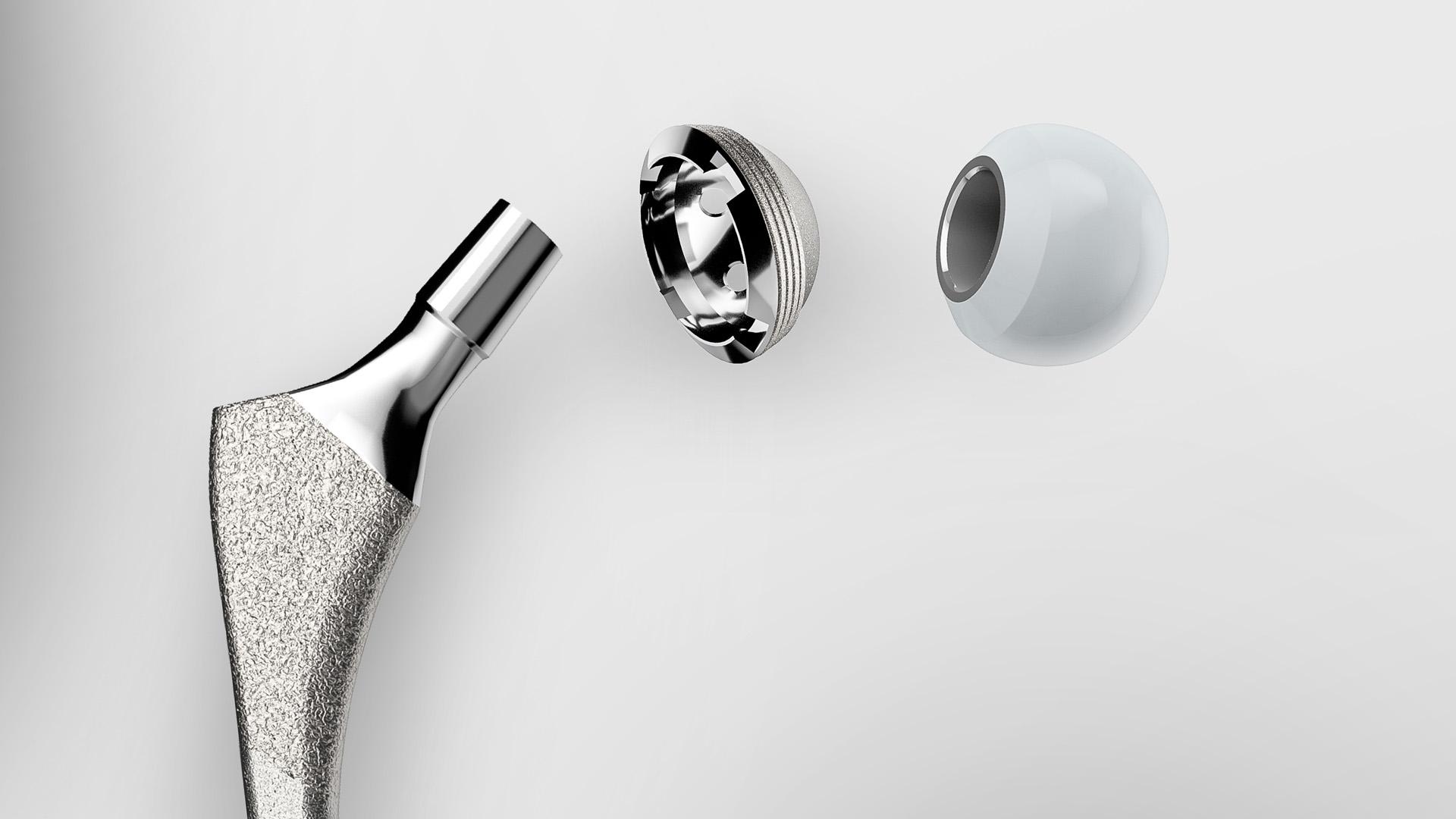 Entdecken Sie die Quality Gates und Lösungen für den Produktionsprozess orthopädischer Implantate
