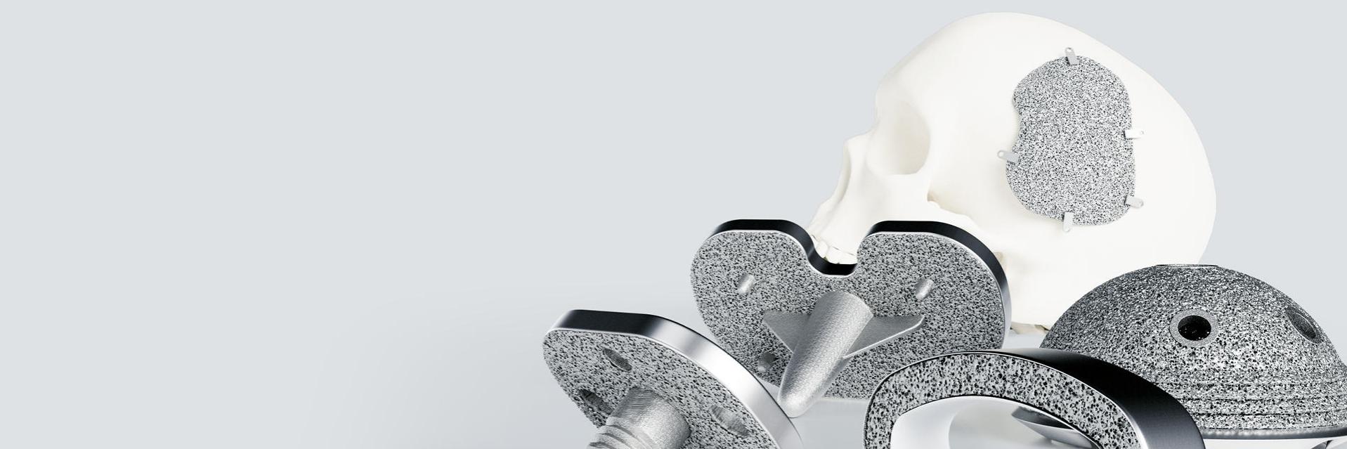 Qualitätssicherung additiv gefertigter Implantate