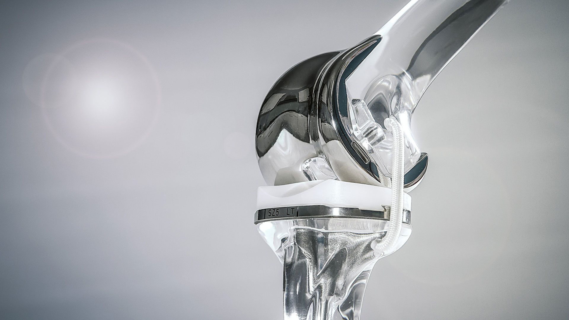 Anwendungsbeispiel für ein komplettes Knieimplantat von Orchid Orthopedic Solutions.