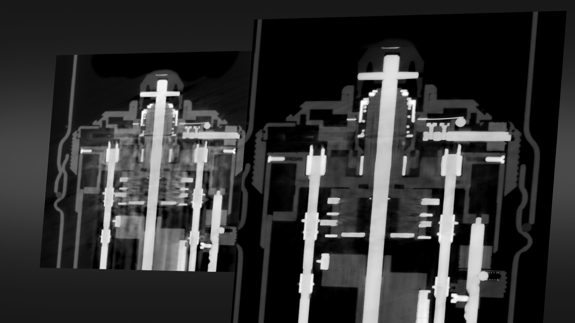 Multimaterial-Artefaktreduktion