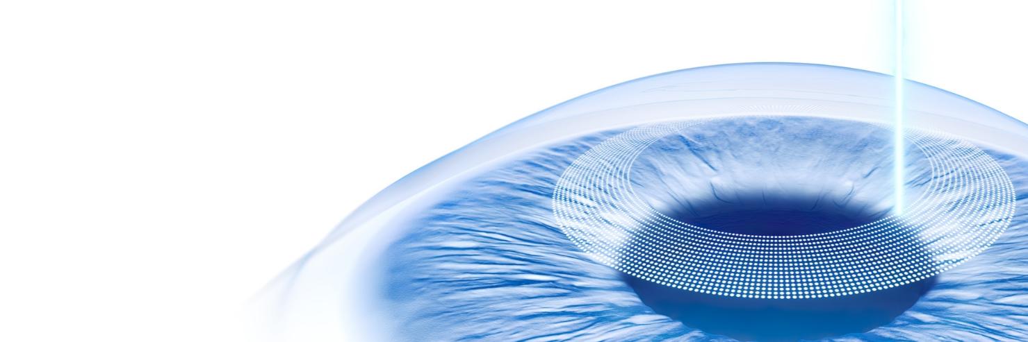 Corneal Refractive Workflow