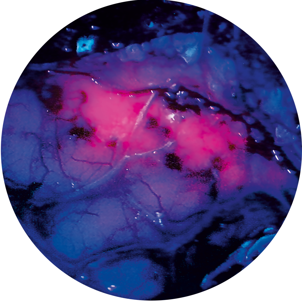 BLUE 400