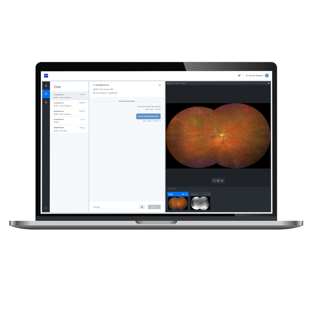 Illustration von ZEISS Collaborative Care