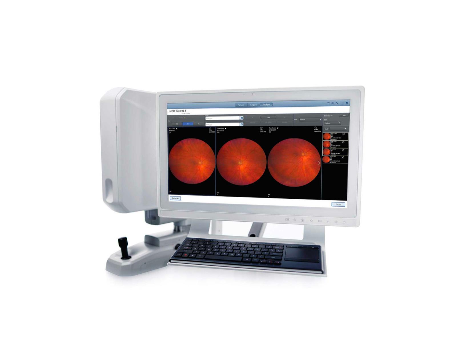 ZEISS Netzhautkameras