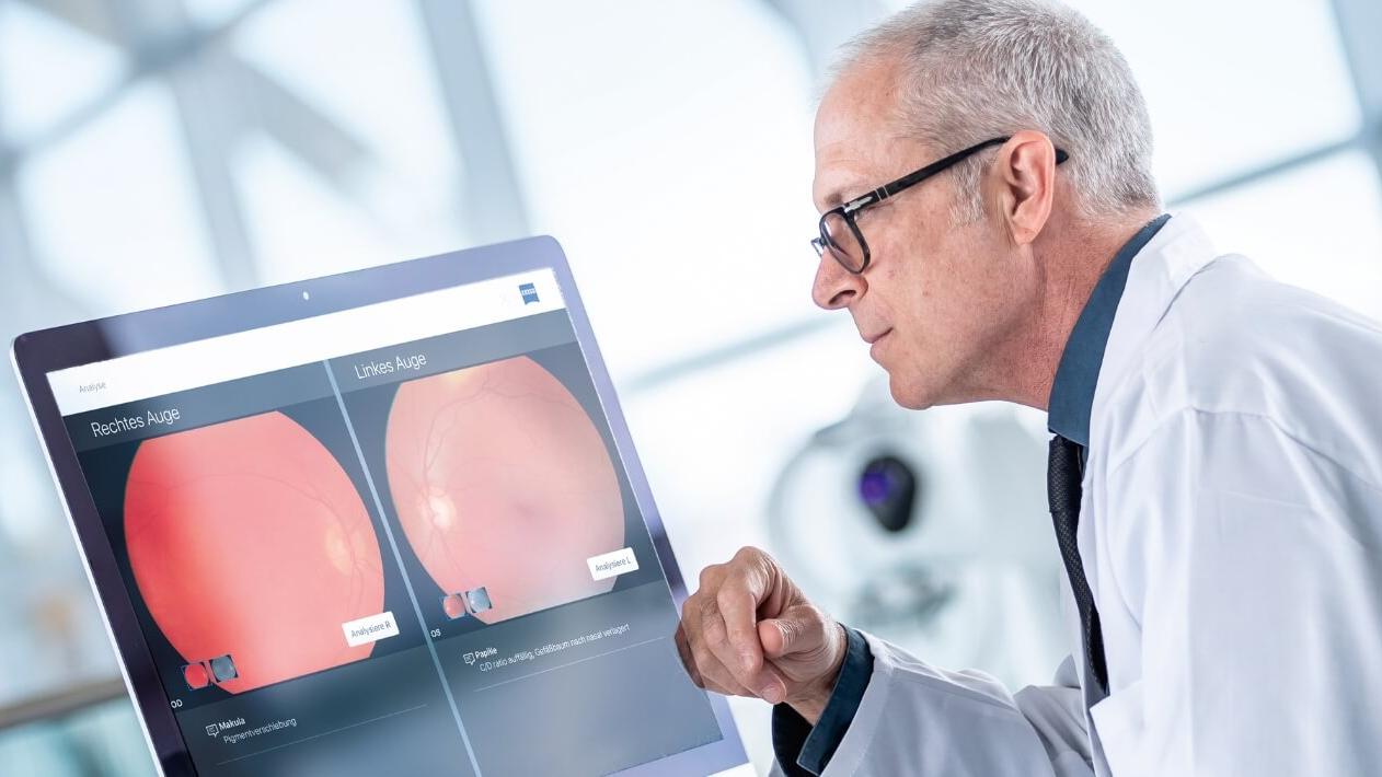 Auswertung durch das Ocumeda Augenarztnetzwerk