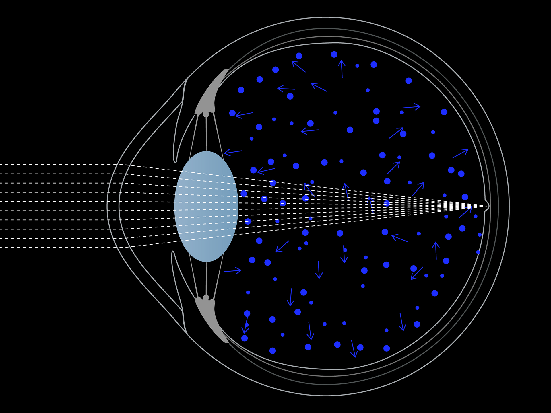 Schematische Visualisierung der Blaulichtstreuung im Auge
