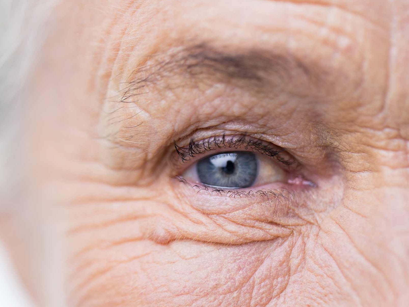 Die Abbildung zeigt eine Nahaufnahme eines erkrankten Auges und veranschaulicht mögliche Gefahren für die Augenumgebung. 